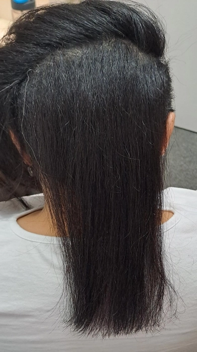 Level 2 coarse dark hair before Dikson Violet Booster+